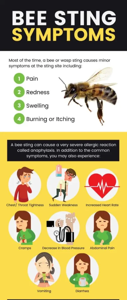 Bee Sting Home Remedies: मधुमक्खी ने काटा है? तुरंत करें ये घरेलू उपाय, नहीं फैलेगा जहर 9 Bee Sting Home Remedies
